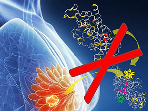 Estrogen Metabolism & Breast Cancer Risk